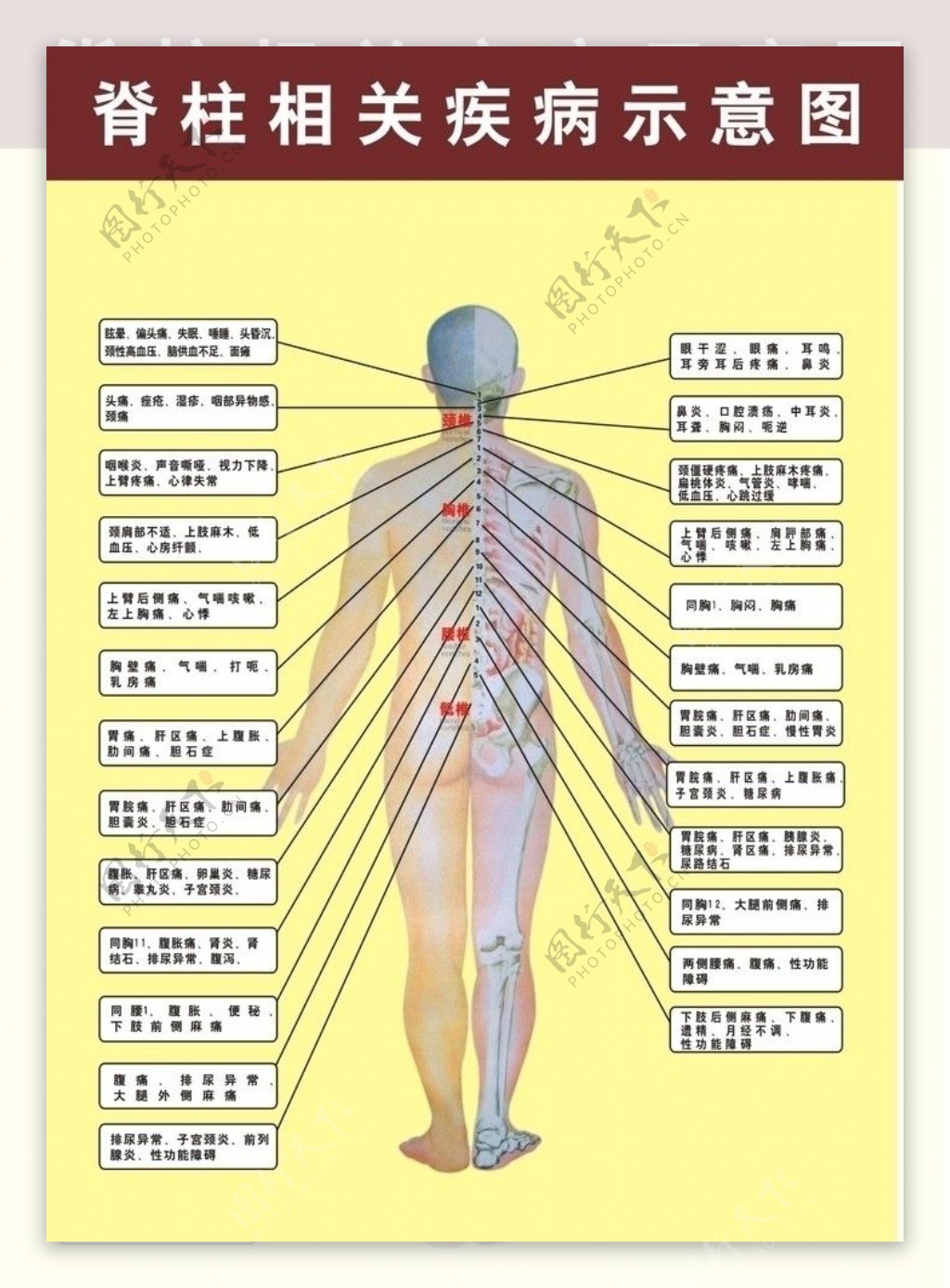 脊柱相关疾病图片