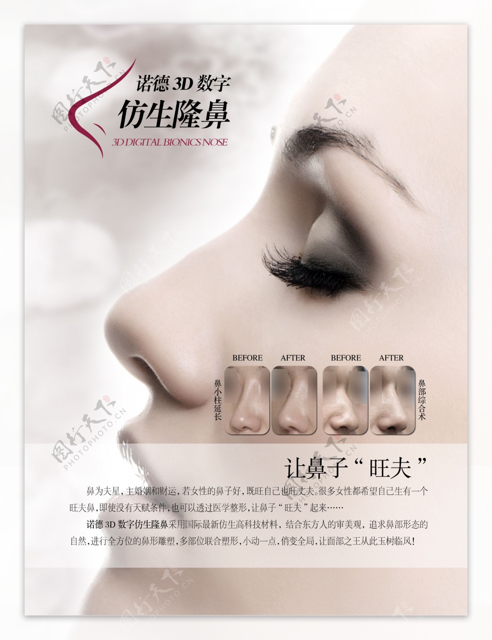 3D仿生隆鼻图片