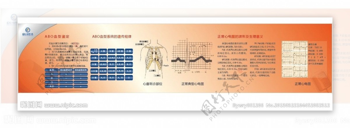 血型心电图图片