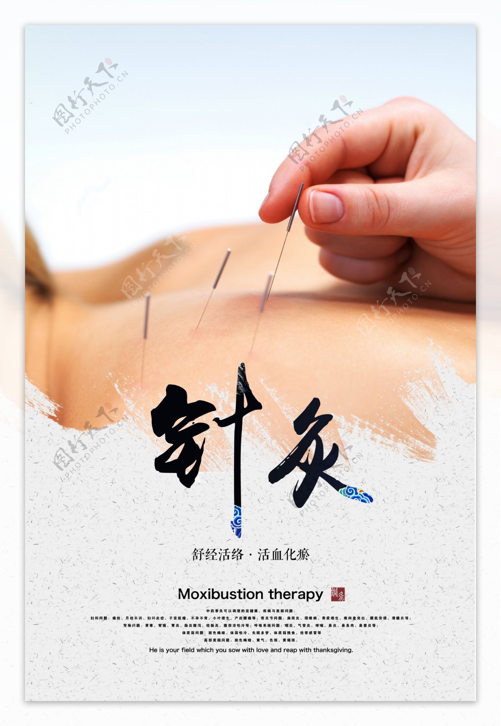 中国传统针灸照片摄影图片_ID:315395338-Veer图库