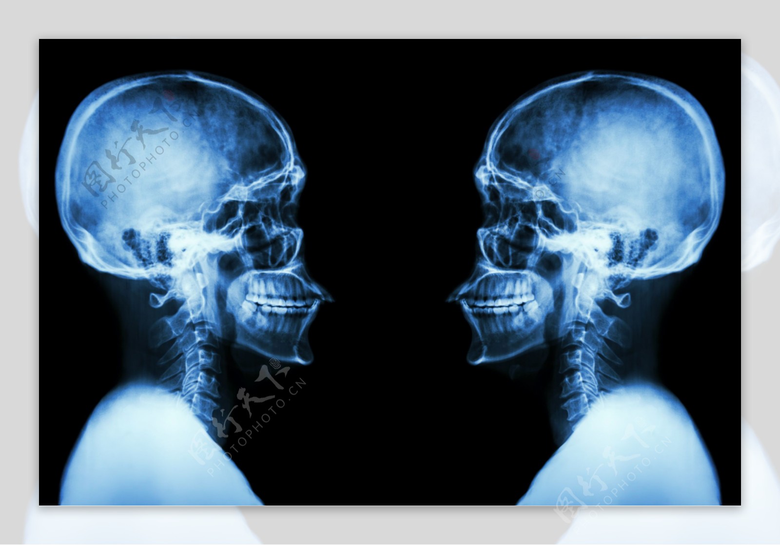 X光脑部透视图图片