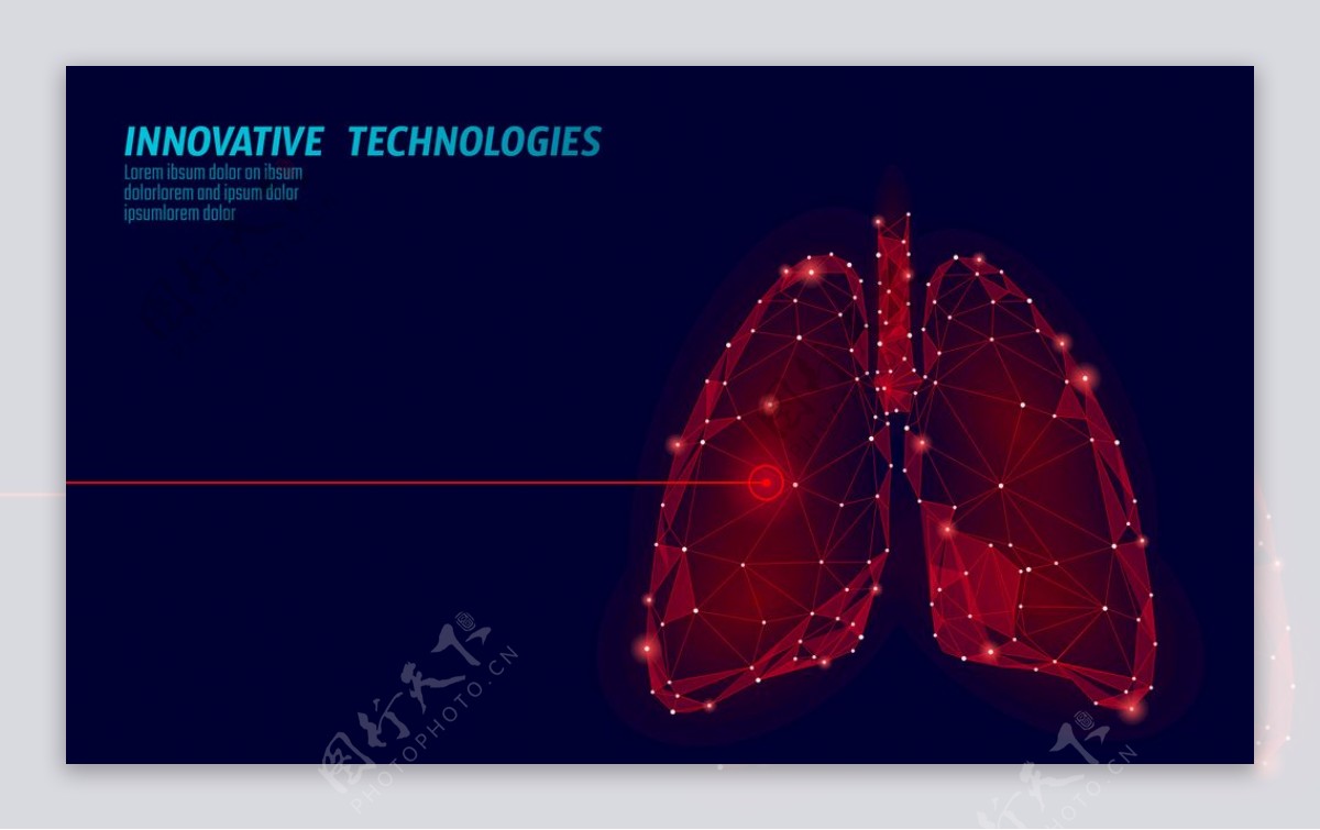 科技肺部